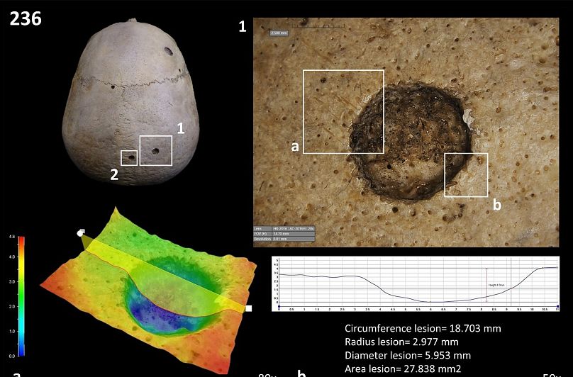 The skull is thought to have belonged to a man living around the same time the Great Pyramid of Giza was built.